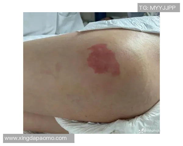 卡斯尔髋部受伤,下周复查进展